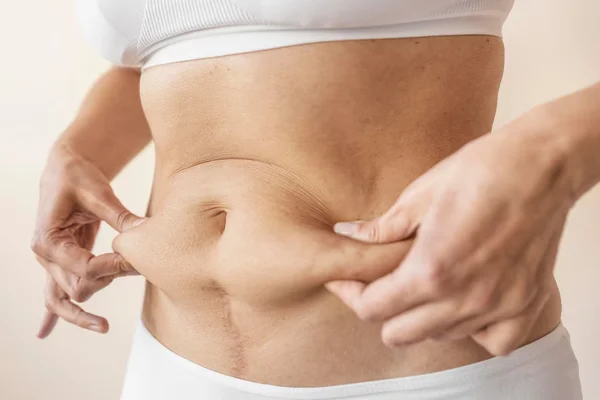 eliminar la grasa abdominal de forma segura